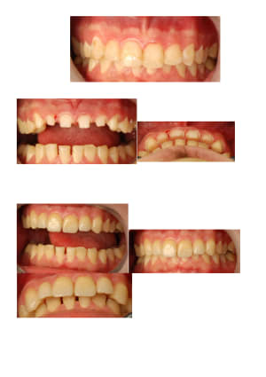 Liad 2013 11 22 b89uz7 - Eugenol