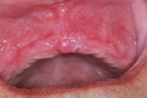 Maxillaire1 yqrxms - Eugenol