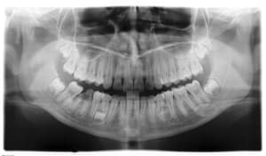 Moosun i 20070502 2951 lwmelh - Eugenol