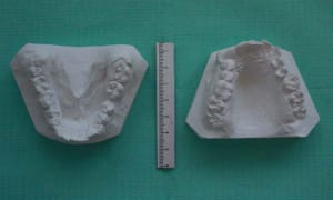 Moulage 1 vlrapq - Eugenol