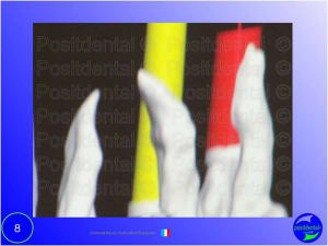 Mise en chage imm diate 008 goibae - Eugenol