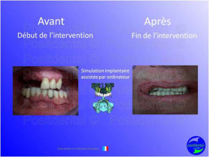 Mise en chage imm diate 028 fdwwr4 - Eugenol