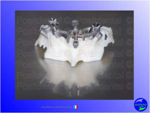 Mise en chage imm diate 036 liqphr - Eugenol