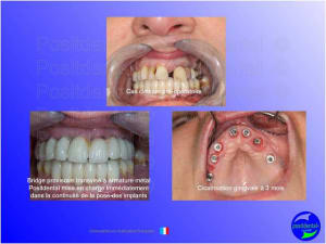 Mise en chage imm diate 046 pircio - Eugenol