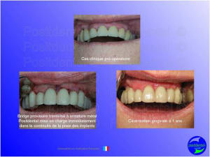 Mise en chage imm diate 051 eccijx - Eugenol