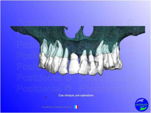 Mise en chage imm diate 055 qxnjtl - Eugenol