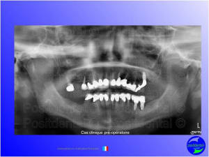 Mise en chage imm diate 056 yue8ud - Eugenol