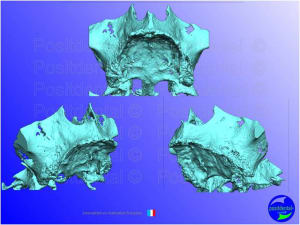 Mise en chage imm diate 127 l5cc6g - Eugenol