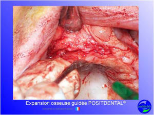 Mise en chage imm diate 132 sdmebm - Eugenol