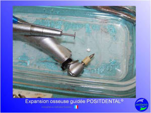 Mise en chage imm diate 139 fuarym - Eugenol