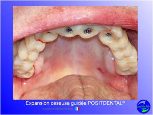 Mise en chage imm diate 162 n0bkuy - Eugenol