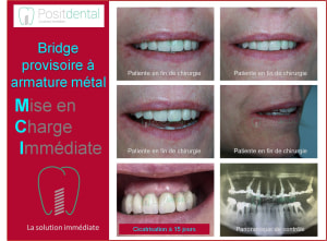 Mise en charge immédiate 010 vu5t9y - Eugenol