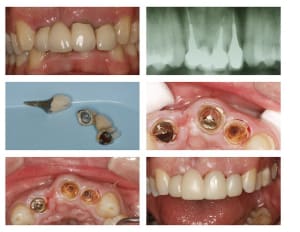 Montage 12 22 small cpdtai - Eugenol