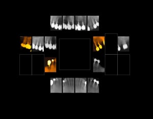 Mrs x2 tdb757 - Eugenol