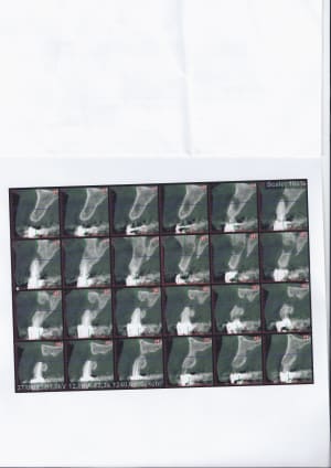 N3 racrl9 - Eugenol