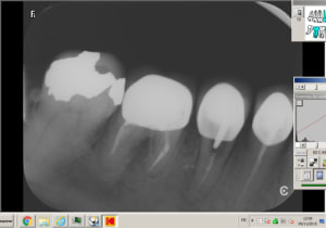 New picture  1  i1s5ud - Eugenol