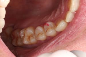 Oim haut droite qjqccc - Eugenol