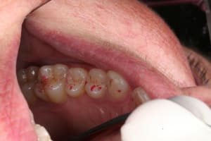 Oim haut gauche rtfqsa - Eugenol