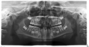 Odontome 21 km81ek - Eugenol