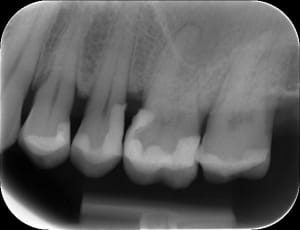 P0052114 20120913 dr39443 bkvpvr - Eugenol