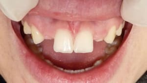 P1000223 wn1tju - Eugenol