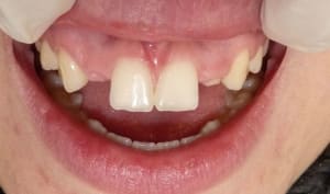 P1000224 uosvpe - Eugenol