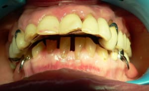 P1050120 cly4k9 - Eugenol