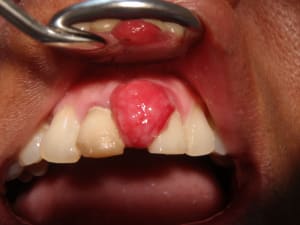 P4030064 mb0iva - Eugenol