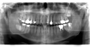 Pano fuxfwb - Eugenol