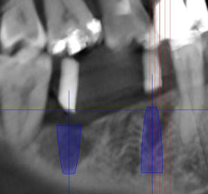 Pano u9k7hm - Eugenol