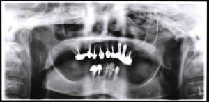 Pano z1ztl0 - Eugenol