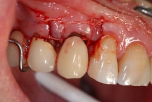Pap feptx8 - Eugenol
