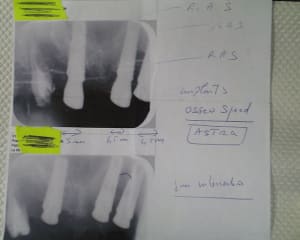 Pic00018 pbxtjr - Eugenol