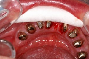 Pict1611 qw5qo0 - Eugenol