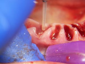 Positdental 141120 143 gdedv2 - Eugenol