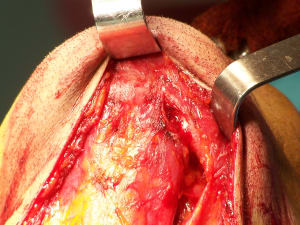 Positdental 141229 019 zgtmv4 - Eugenol