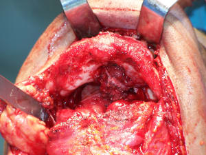 Positdental 141229 032 qq0ozw - Eugenol