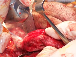 Positdental 141229 043 lntndy - Eugenol