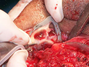 Positdental 141229 064 bvvrzc - Eugenol