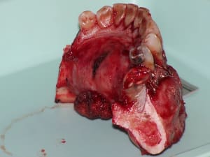 Positdental 141229 070 sne0hc - Eugenol