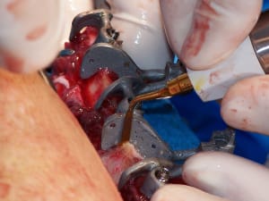 Positdental 141229 114 yqjkfh - Eugenol