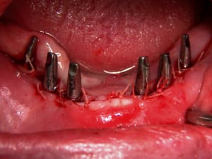 Positdental 14 08 19 066 rsufxx - Eugenol