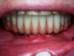 Positdental 14 08 19 080 eqymuy - Eugenol