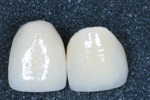 Pr  op couronnes 11 21 004 ed2fte - Eugenol
