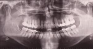Photo 001 hyovks - Eugenol