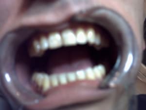 Photo 004 pihczx - Eugenol