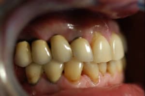Picture1 bagbon - Eugenol