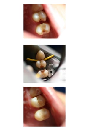 Planche contact 1 t2f5ra - Eugenol