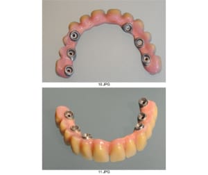 Planche contact 005 amkylq - Eugenol