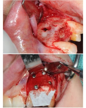 Planche contact 007 od0dqj - Eugenol